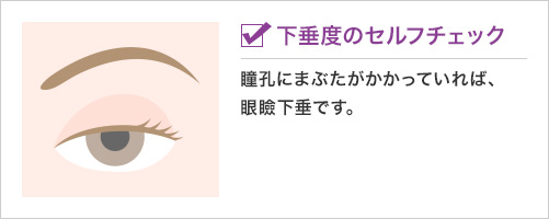 眼瞼下垂セルフチェック法