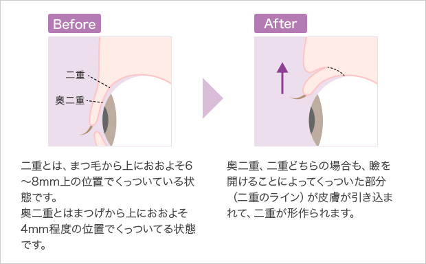 二重の仕組み